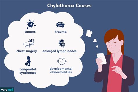 Chylothorax: Causes, Symptoms & Treatment